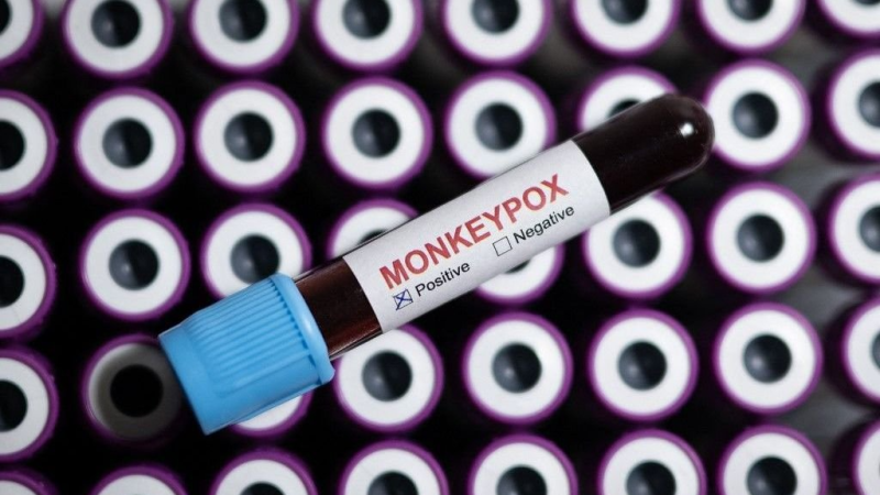 Mpox