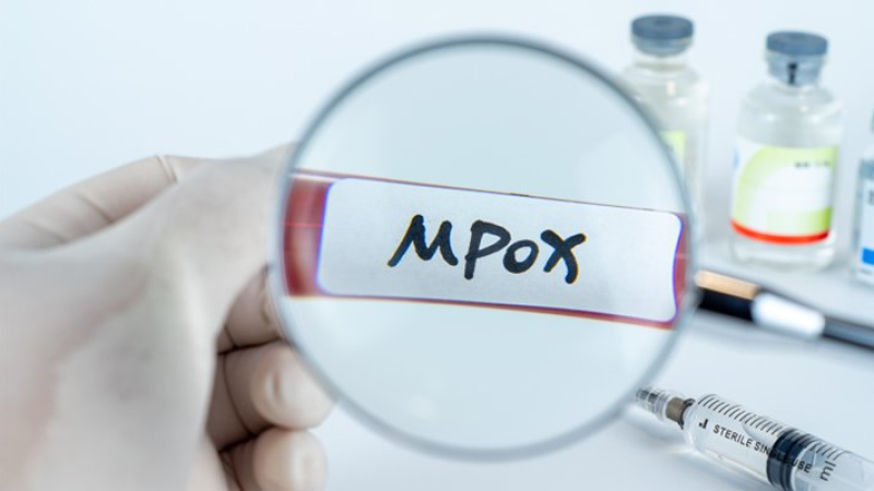 Mpox