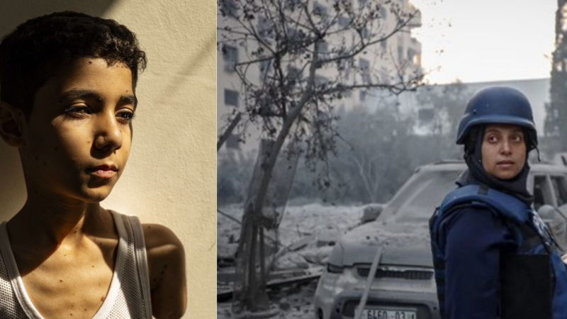 World Press Photo : Le cliché d’un enfant palestinien amputé primé