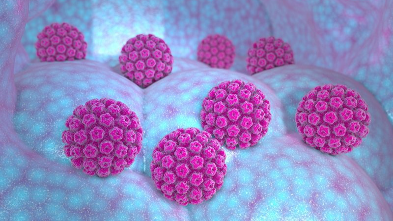 Papillomavirus: Objectif, vacciner 90% des jeunes filles d'ici 2030