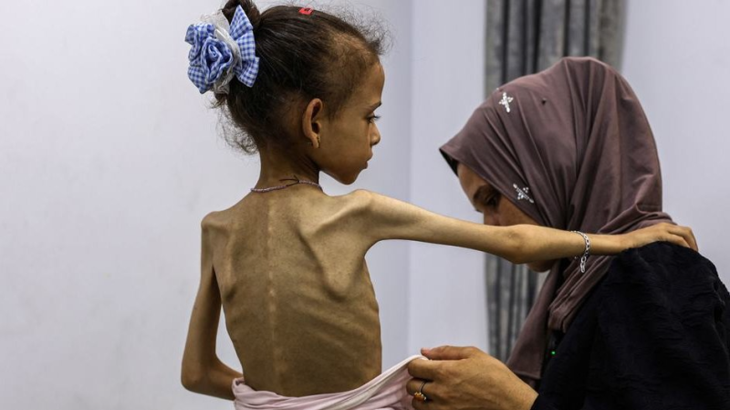 أطفال غزة يحتضرون ببطيء جراء الجوع