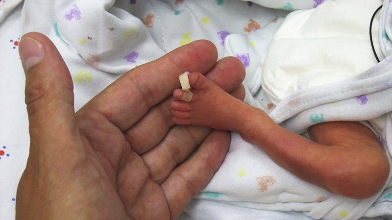 نجاح طبي: إنقاذ رضيع وُلد بوزن 430 غراما إنقاذ رضيع وُلد بوزن 430 غراما