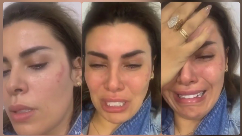 محامي سفيان سيالة ينفي تعنيف موكله لأماني السويسي محامي سفيان سيالة ينفي تعنيف موكله لأماني السويسي