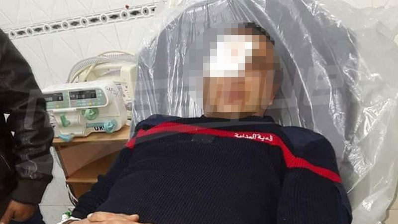 Gafsa : un agent de la protection civile blessé à l’œil agent-blessé
