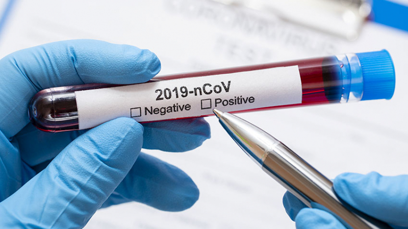 Coroanvirus: Deux nouvelles contaminations à Mahdia Coroanvirus: Deux nouvelles contaminations à Mahdia