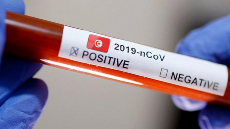 coronavirus