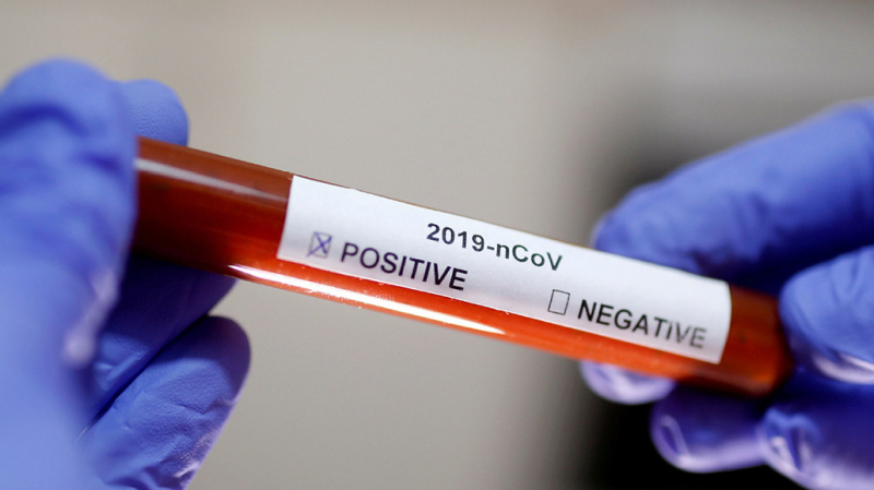 coronavirus 