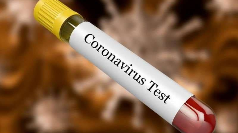 Coronavirus: 514 morts en 24 heures en Espagne coronavirus