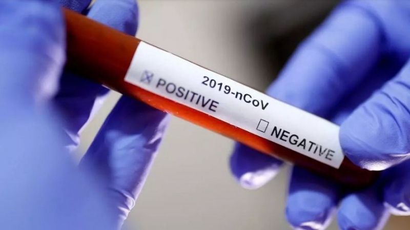 kef: Un homme testé positif au coronavirus après sa mort Coronavirus