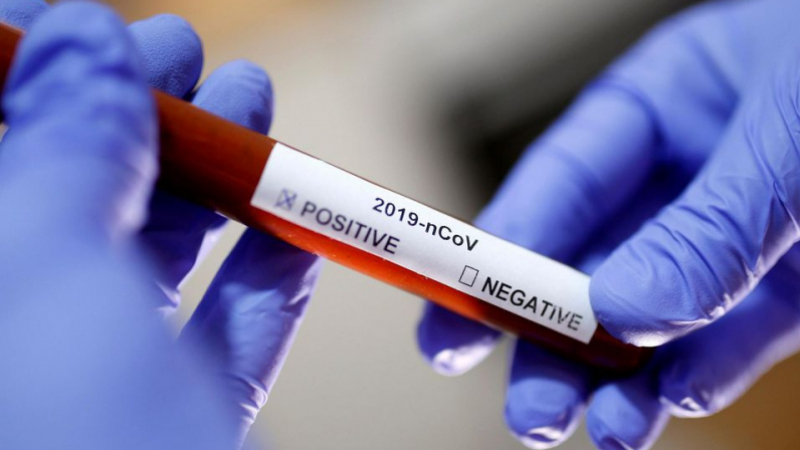 coronavirus