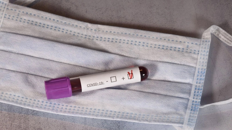Un nouveau cas de coronavirus au centre de quarantaine de Sousse coronavirus
