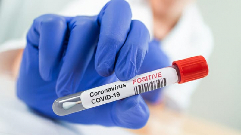 coronavirus 