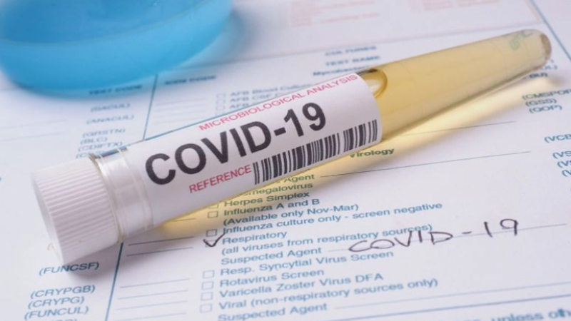 coronavirus