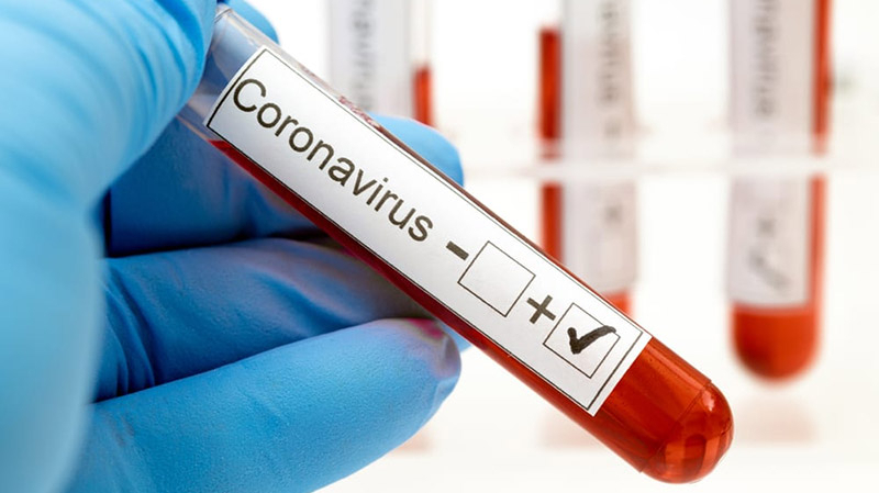 coronavirus