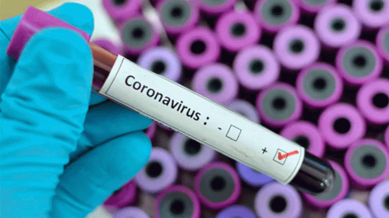 Coronavirus: 18 nouvelles contaminations au kef coronavirus