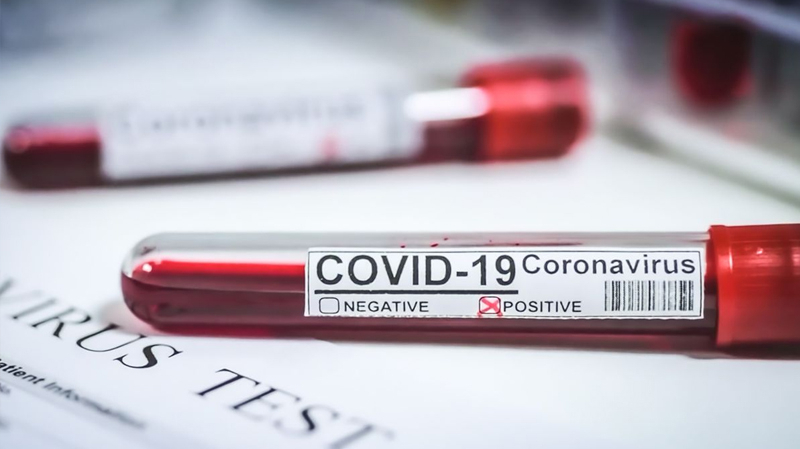 Coronavirus : 477 nouveaux cas enregistrés Coronavirus