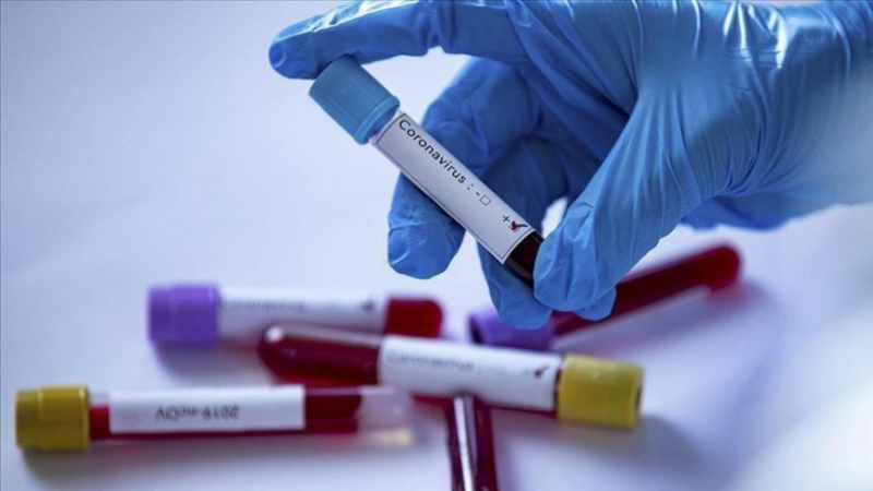 coronavirus