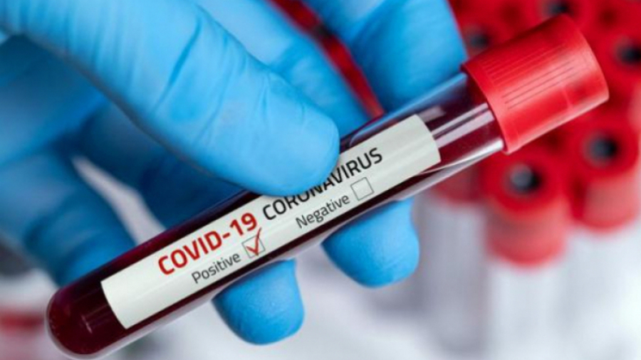 Coronavirus: 26 décès et 662 nouvelles contaminations coronavirus