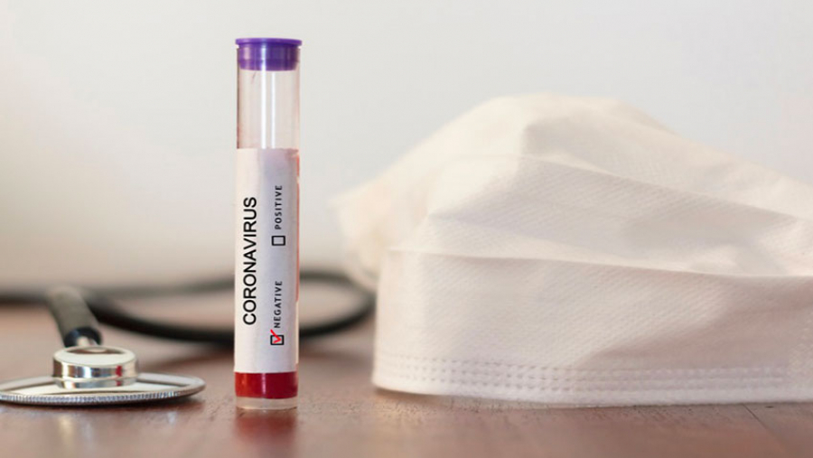 Covid-19 : Un décès et 219 contaminations le 3 décembre 2021 coronavirus