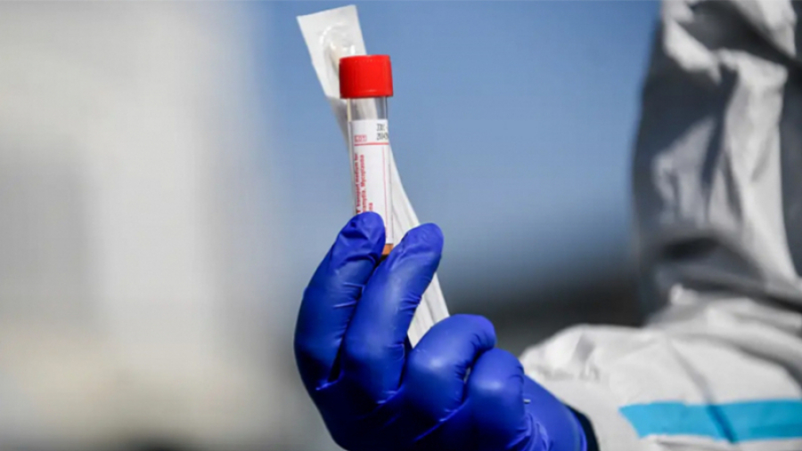 Quatre décès et 2834 nouveaux cas de coronavirus en une journée coronavirus