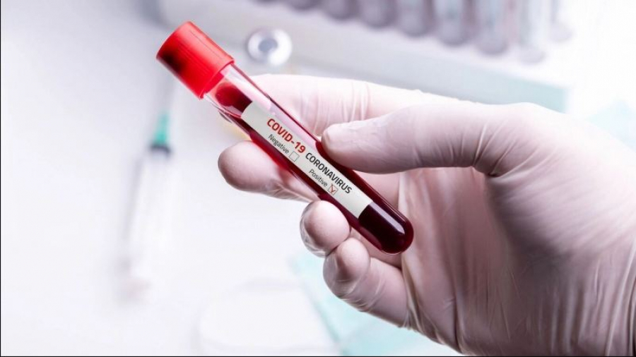 Coronavirus: Trois décès en une semaine coronavirus