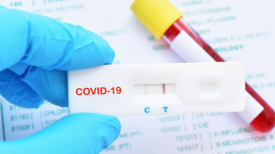 Coronavirus 