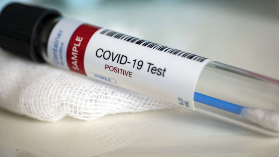 Covid-19 : Trois décès et 61 contaminations en une semaine coronavirus