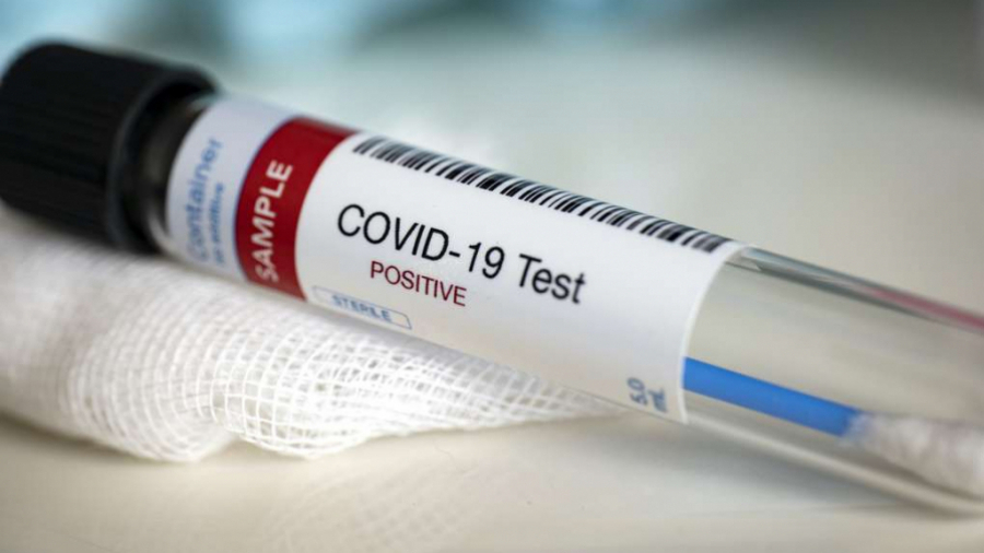 coronavirus