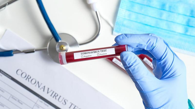 Coronavirus: 22 nouveaux cas en Tunisie