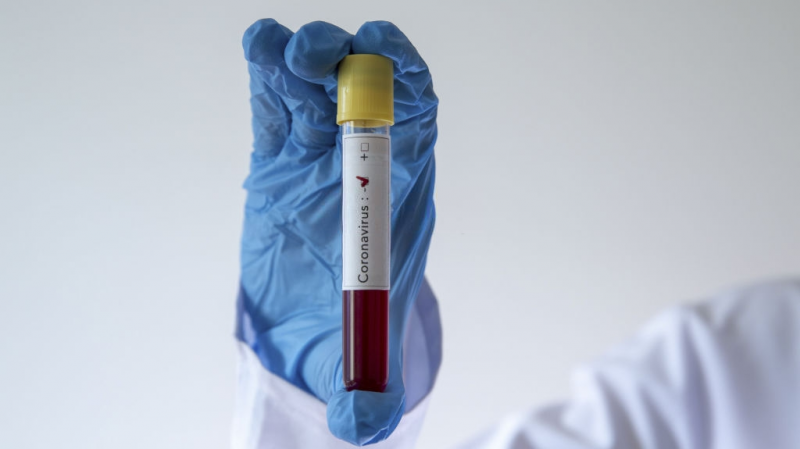 Coronavirus : 5 nouveaux cas importés et 950 guérisons