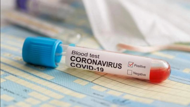 Coronavirus: Huit nouveaux cas recensés
