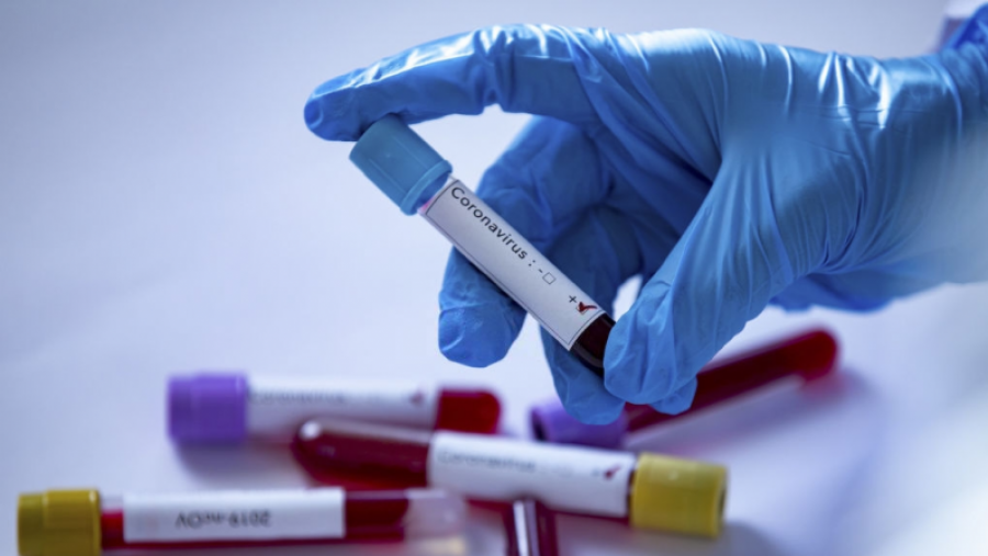 Coronavirus : Situation épidémique dans le gouvernorats 