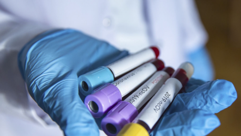 Coronavirus : Situation épidémique dans les gouvernorats 