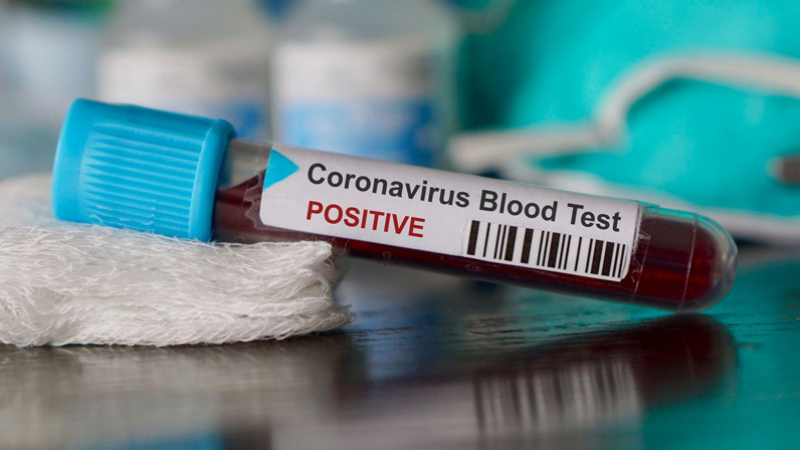 Covid-19 : 64 nouvelles contaminations en Tunisie