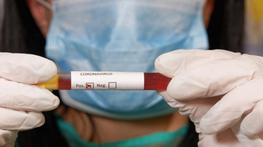 Covid-19: Deux décès et 374 contaminations en 24 heures
