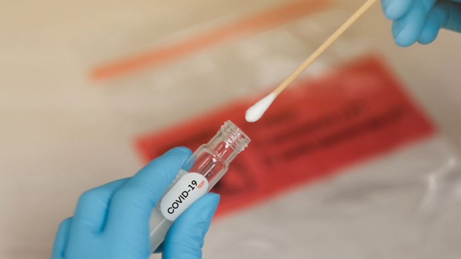 Covid-19: Le taux de positivité des tests monte à environ 32% Covid-19: Le taux de positivité des tests remonte à environ 32%