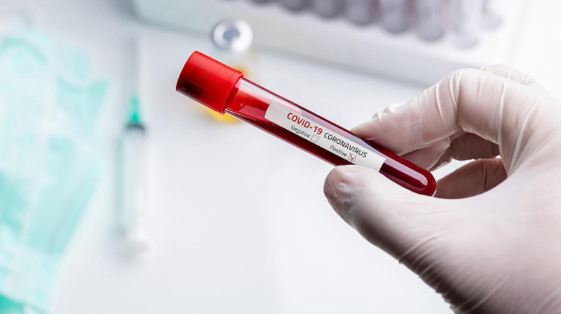 Deux cas importés de coronavirus en Tunisie