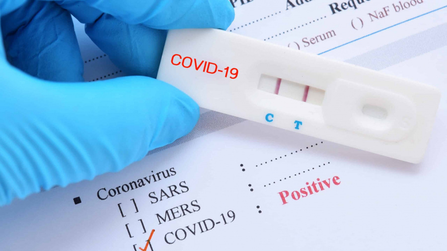 Le ministre brésilien de la Santé positif à la Covid Le ministre brésilien de la Santé positif à la Covid