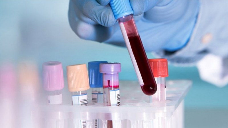 Ministère de la santé: Trois nouveaux cas de Coronavirus