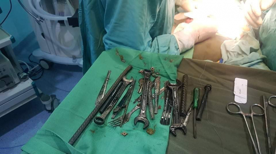 Kasserine: Des clés et des clous dans l'estomac d'un malade objets métalliques