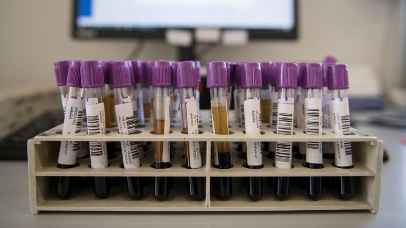 Institut Pasteur: Plateforme pour les tests de diagnostic du Covid-19 Test Covid-19