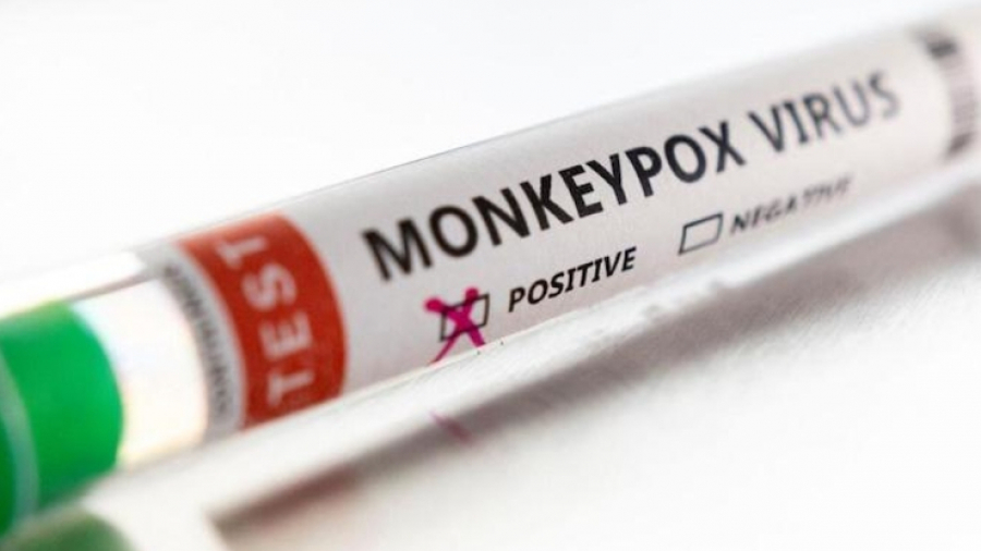 Variole du singe: premier cas aux Émirats Variole du singe