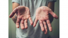 جدري القردة.. منظمة الصحة العالمية توجّه نداء